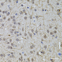 Immunohistochemistry of paraffin-embedded Mouse brain using SLC32A1 Polyclonal Antibody