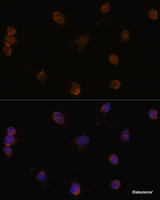 Immunofluorescence analysis of Y79 cells using SLC32A1 Polyclonal Antibody at dilution of 1:100 (40x lens) . Blue: DAPI for nuclear staining.