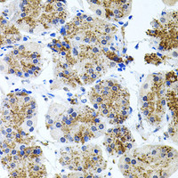 Immunohistochemistry of paraffin-embedded Human stomach using SSTR2 Polyclonal Antibody at dilution of 1:100 (40x lens) .