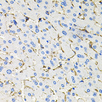 Immunohistochemistry of paraffin-embedded Human liver damage using SSTR2 Polyclonal Antibody at dilution of 1:100 (40x lens) .