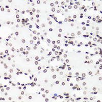 Immunohistochemistry of paraffin-embedded Mouse kidney using MonoMethyl-Histone H3-R17 Polyclonal Antibody at dilution of 1:100 (40x lens) .