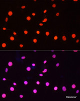 Immunofluorescence analysis of C6 cells using Symmetric DiMethyl-Histone H3-R26 Polyclonal Antibody at dilution of 1:100. Blue: DAPI for nuclear staining.