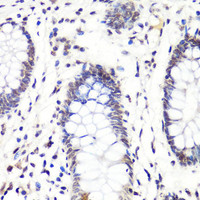 Immunohistochemistry of paraffin-embedded Human colon using Asymmetric DiMethyl-Histone H3-R2 Polyclonal Antibody at dilution of 1:100 (40x lens) .