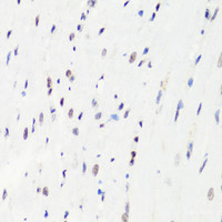 Immunohistochemistry of paraffin-embedded Rat heart using MonoMethyl-Histone H3-R8 Polyclonal Antibody at dilution of 1:100 (40x lens) .