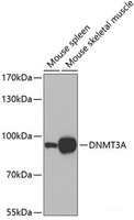 Western blot analysis of extracts of various cell lines using DNMT3A Polyclonal Antibody.