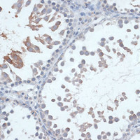 Immunohistochemistry of paraffin-embedded Rat testis using FSHR Polyclonal Antibody at dilution of 1:100 (40x lens) .