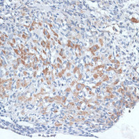 Immunohistochemistry of paraffin-embedded Rat ovary using FSHR Polyclonal Antibody at dilution of 1:100 (40x lens) .
