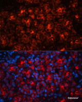 Immunofluorescence analysis of Rat kidney using LCN2 Polyclonal Antibody at dilution of 1:100. Blue: DAPI for nuclear staining.