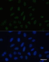 Immunofluorescence analysis of U-2 OS cells using PELP1 Polyclonal Antibody at dilution of 1:100 (40x lens) . Blue: DAPI for nuclear staining.