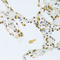 Immunohistochemistry of paraffin-embedded Human lung using NLK Polyclonal Antibody at dilution of 1:100 (40x lens) .