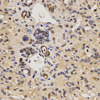 Immunohistochemistry of paraffin-embedded Mouse liver fibrosis using FAM160B2 Polyclonal Antibody at dilution of 1:200 (40x lens) .