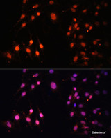 Immunofluorescence analysis of C6 cells using SETD2 Polyclonal Antibody at dilution of 1:100 (40x lens) . Blue: DAPI for nuclear staining.