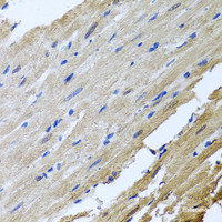 Immunohistochemistry of paraffin-embedded Rat heart using CAMK2G Polyclonal Antibody at dilution of 1:100 (40x lens) .