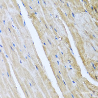 Immunohistochemistry of paraffin-embedded Mouse heart using CAMK2G Polyclonal Antibody at dilution of 1:100 (40x lens) .