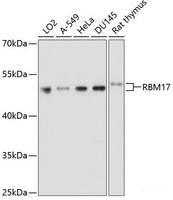 Western blot analysis of extracts of various cell lines using RBM17 Polyclonal Antibody at dilution of 1:1000.