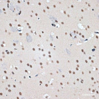 Immunohistochemistry of paraffin-embedded Mouse brain using RBM17 Polyclonal Antibody at dilution of 1:100 (40x lens) .