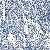 Immunohistochemistry of paraffin-embedded Mouse spleen using RBM17 Polyclonal Antibody at dilution of 1:100 (40x lens) .