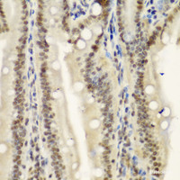 Immunohistochemistry of paraffin-embedded Mouse Intestine using NELFE Polyclonal Antibody at dilution of 1:100 (40x lens) .