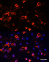 Immunofluorescence analysis of C6 cells using SMO Polyclonal Antibody at dilution of 1:100 (40x lens) . Blue: DAPI for nuclear staining.