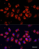 Immunofluorescence analysis of HeLa cells using SMO Polyclonal Antibody at dilution of 1:100 (40x lens) . Blue: DAPI for nuclear staining.