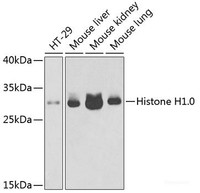 Western blot analysis of extracts of various cell lines using Histone H1. 0 Polyclonal Antibody at dilution of 1:1000.