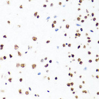 Immunohistochemistry of paraffin-embedded Mouse brain using Histone H1.0 Polyclonal Antibody at dilution of 1:100 (40x lens) .