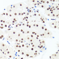 Immunohistochemistry of paraffin-embedded Human stomach using Histone H1.0 Polyclonal Antibody at dilution of 1:100 (40x lens) .