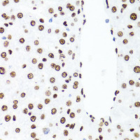 Immunohistochemistry of paraffin-embedded Rat liver using Histone H1.0 Polyclonal Antibody at dilution of 1:100 (40x lens) .