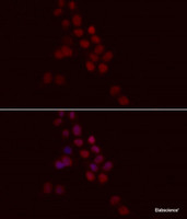 Immunofluorescence analysis of HeLa cells using Histone H1.0 Polyclonal Antibody at dilution of 1:100. Blue: DAPI for nuclear staining.