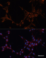 Immunofluorescence analysis of NIH/3T3 cells using ALDH6A1 Polyclonal Antibody at dilution of 1:100. Blue: DAPI for nuclear staining.