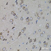 Immunohistochemistry of paraffin-embedded Rat brain using UQCRC1 Polyclonal Antibody at dilution of 1:100 (40x lens) .