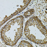 Immunohistochemistry of paraffin-embedded Human prostate using UQCRC1 Polyclonal Antibody at dilution of 1:100 (40x lens) .