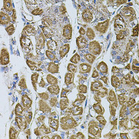 Immunohistochemistry of paraffin-embedded Human stomach using UQCRC1 Polyclonal Antibody at dilution of 1:100 (40x lens) .