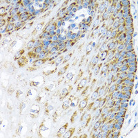 Immunohistochemistry of paraffin-embedded Human esophagus using LRPPRC Polyclonal Antibody at dilution of 1:100 (40x lens) .