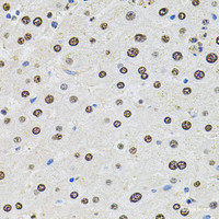 Immunohistochemistry of paraffin-embedded Human liver damage using U2SURP Polyclonal Antibody at dilution of 1:100 (40x lens) .
