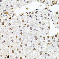 Immunohistochemistry of paraffin-embedded Mouse liver using U2SURP Polyclonal Antibody at dilution of 1:100 (40x lens) .