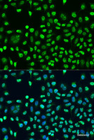 Immunofluorescence analysis of U2OS cells using STAU2 Polyclonal Antibody at dilution of 1:100. Blue: DAPI for nuclear staining.