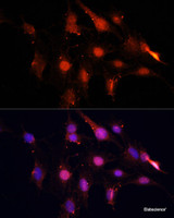 Immunofluorescence analysis of C6 cells using NSUN2 Polyclonal Antibody at dilution of 1:100. Blue: DAPI for nuclear staining.
