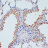 Immunohistochemistry of paraffin-embedded Mouse lung using SLC39A4 Polyclonal Antibody at dilution of 1:100 (40x lens) .