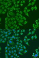 Immunofluorescence analysis of U2OS cells using SUGCT Polyclonal Antibody at dilution of 1:100. Blue: DAPI for nuclear staining.