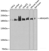 Western blot analysis of extracts of various cell lines using ARHGAP5 Polyclonal Antibody at dilution of 1:1000.