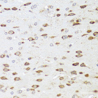 Immunohistochemistry of paraffin-embedded Rat brain using ARHGAP5 Polyclonal Antibody at dilution of 1:100 (40x lens) .