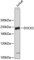 Western blot analysis of extracts of Jurkat cells using DOCK2 Polyclonal Antibody.
