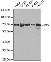 Western blot analysis of extracts of various cell lines using PLS3 Polyclonal Antibody at dilution of 1:1000.