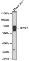 Western blot analysis of extracts of Mouse brain using PPP3CB Polyclonal Antibody at dilution of 1:1000.