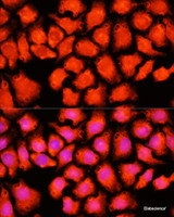 Immunofluorescence analysis of HeLa cells using ACO2 Polyclonal Antibody at dilution of 1:100 (40x lens) . Blue: DAPI for nuclear staining.