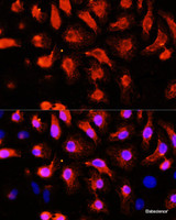 Immunofluorescence analysis of HeLa cells using ACTN2 Polyclonal Antibody at dilution of 1:100 (40x lens) . Blue: DAPI for nuclear staining.