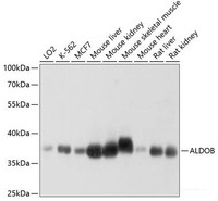 Western blot analysis of extracts of various cell lines using ALDOB Polyclonal Antibody at dilution of 1:1000.