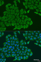 Immunofluorescence analysis of U2OS cells using ANXA7 Polyclonal Antibody at dilution of 1:100. Blue: DAPI for nuclear staining.