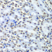 Immunohistochemistry of paraffin-embedded Mouse kidney using SEPT7 Polyclonal Antibody at dilution of 1:100 (40x lens) .